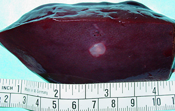 An obvious tapeworm cyst on a moose liver