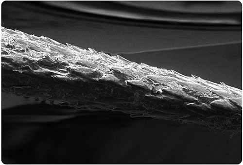 A 150x magnified view of a porcupine quill showing backwardfacing barbs on the tip tip is to the right Photo courtesy Kathryn Everson used with permission Everson Lab at Oregon State University   httpswwweversonlaborg