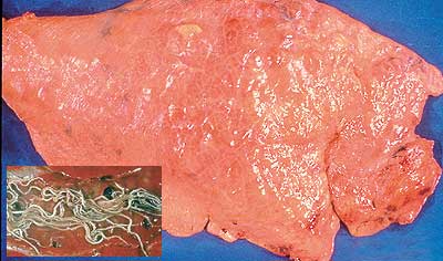 Lung with dark infected areas Inset Enlarged adult worms in airway